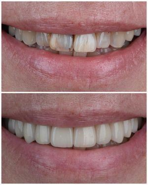 Image post by @sharpdentistry on Instagram