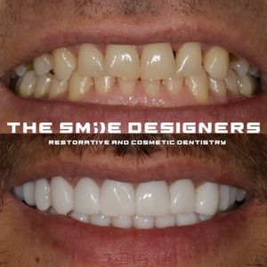 Image post by @fahaddentist on Instagram