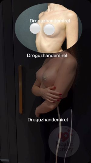 Video post by @droguzhandemirel on Instagram