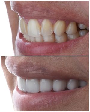Image post by @sharpdentistry on Instagram