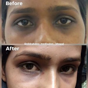 Image post by @nikkybawamedisalonbhopal on Instagram