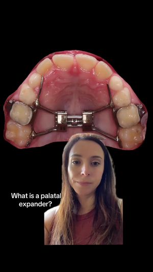 Video post by @weisstorortho on TikTok