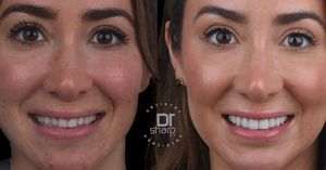 Image post by @sharpdentistry on Instagram