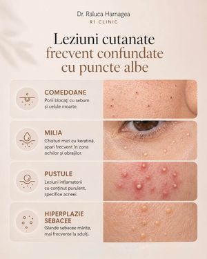Image post by @dr.ralucaharnagea on Instagram