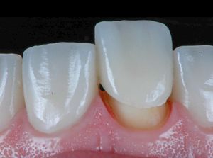 Image post by @sharpdentistry on Instagram