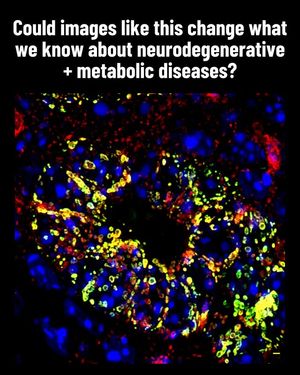 Image post by @chanzuckerberginitiative on Instagram