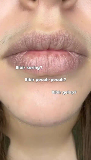 Image post by @noerabeauty on TikTok