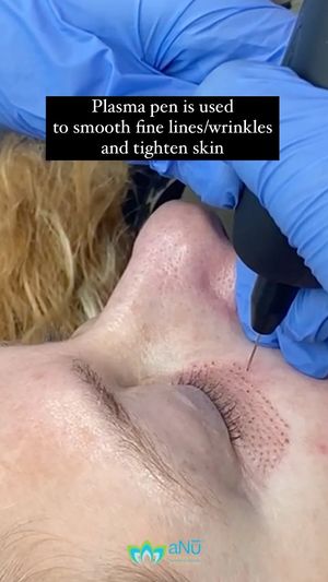 Video post by @anuaestheticsandwellness on Instagram