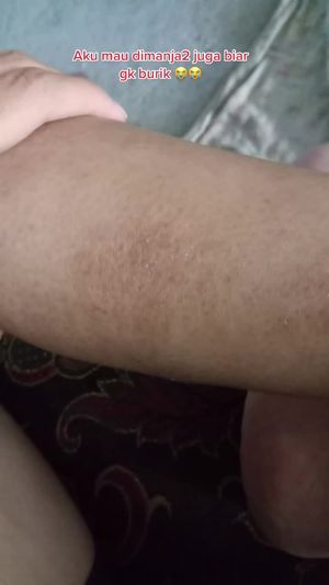 Video post by @lili.refliskin on TikTok
