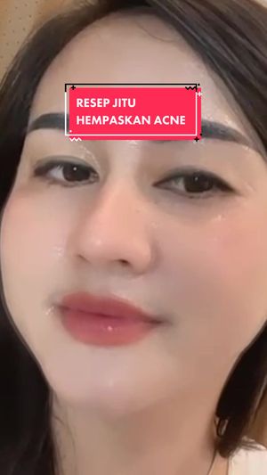 Video post by @lili.refliskin on TikTok