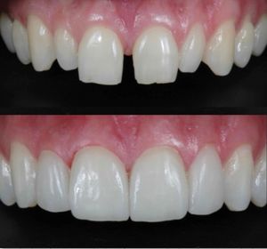 Image post by @sharpdentistry on Instagram