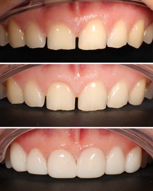 Image post by @fahaddentist on Instagram