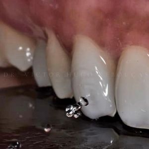 Image post by @dr.victorhugor on Instagram