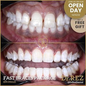 Image post by @drrezdental on Facebook