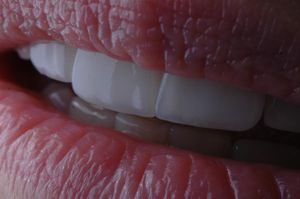 Image post by @sharpdentistry on Instagram