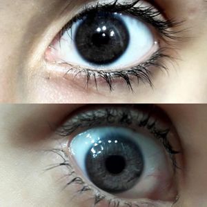 Image post by @irexlaser on Instagram