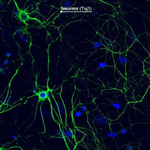 Image post by @biohub on Instagram