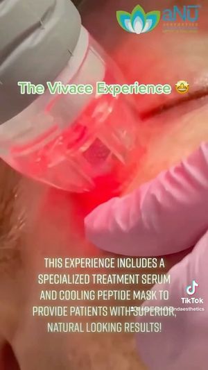 Video post by @anuaestheticsandwellness on Instagram