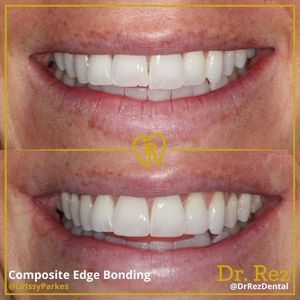 Image post by @drrezdental on Facebook