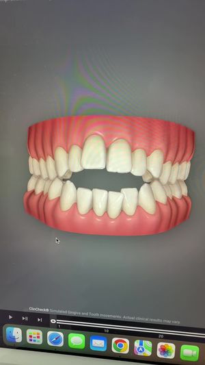 Video post by @weisstorortho on TikTok