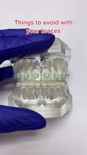 Video post by @weisstorortho on TikTok