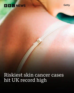 Image post by @bbcnews on TikTok