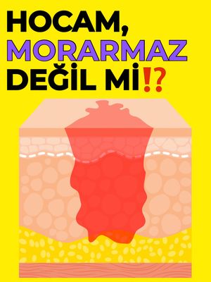 Image post by @drozlemteberik on Instagram