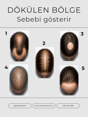Image post by @drozlemteberik on Instagram