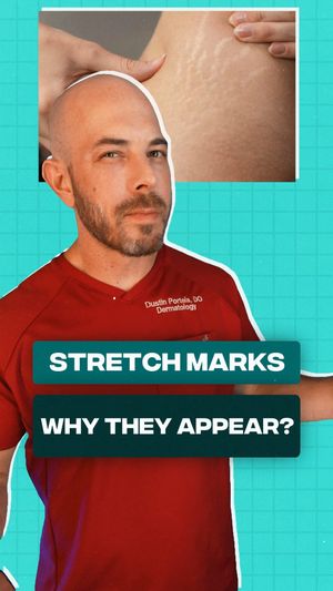 Video post by @drdustinportela on Instagram