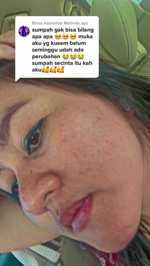 Video post by @lili.refliskin on TikTok