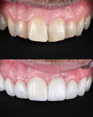Image post by @fahaddentist on Instagram