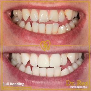 Image post by @drrezdental on Facebook