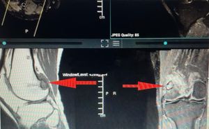 Image post by @thelewinclinic on Instagram