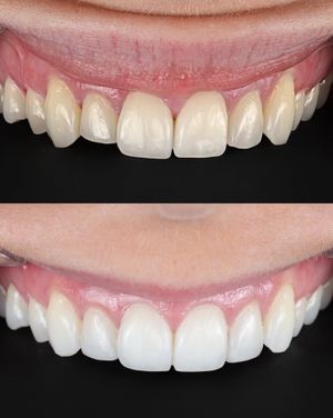 Image post by @fahaddentist on Instagram