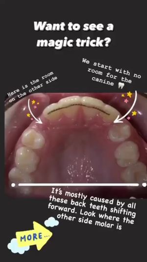 Video post by @weisstorortho on TikTok