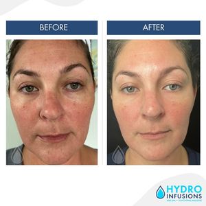 Image post by @hydromedspa on Facebook