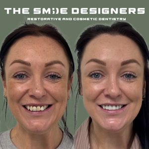Image post by @fahaddentist on Instagram