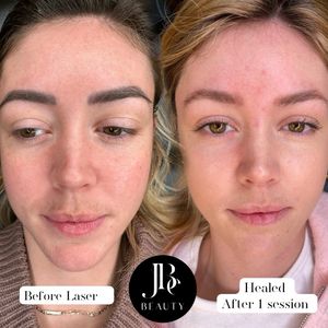 Image post by @jbebeautydenver on Instagram