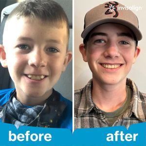 Image post by @invisalign on Instagram