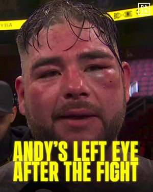Image post by @daznboxing on Instagram