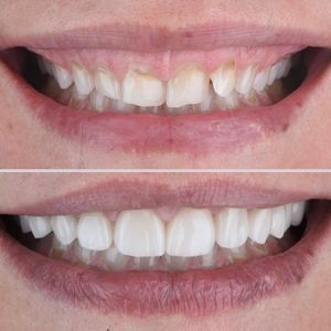 Image post by @sharpdentistry on Instagram