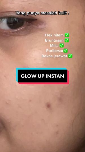 Video post by @lili.refliskin on TikTok