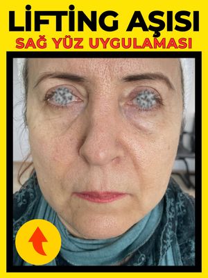 Image post by @drozlemteberik on Instagram