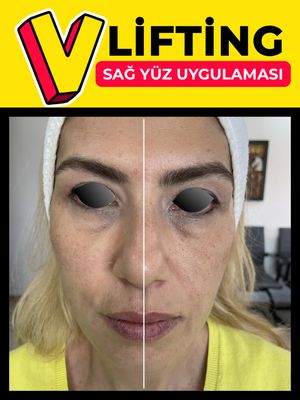 Image post by @drozlemteberik on Instagram