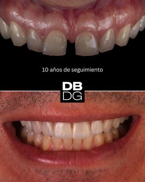 Image post by @drdelfinbarquero on Instagram