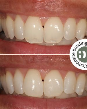 Image post by @fahaddentist on Instagram