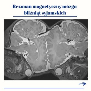Image post by @neurochirurg_litak on Instagram