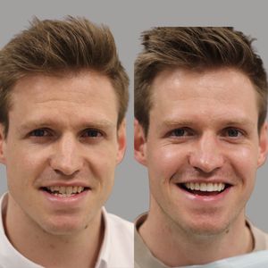 Image post by @fahaddentist on Instagram