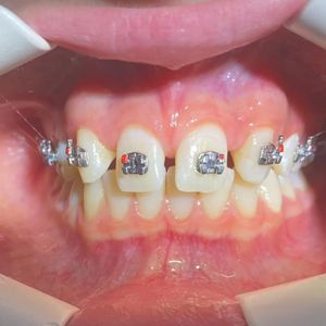 Image post by @dentamerzifon on Instagram