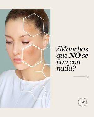 Image post by @leyla.skincareandbeauty on Instagram